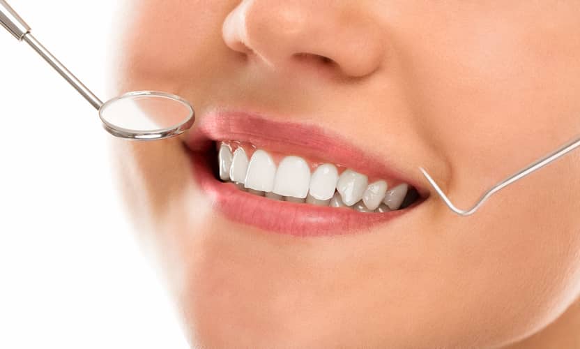 علاج الأسنان في ألانيا داخل عيادة ابتسامة متميزة 3